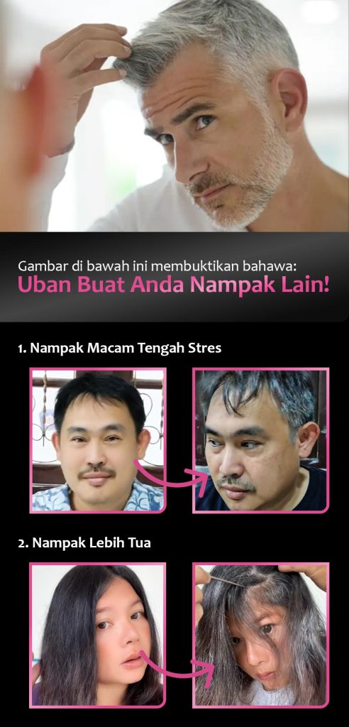 penyebab uban di usia muda